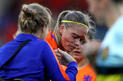 Dekker relativeert bloederige wond: Ach, mijn hoofd zit er nog op