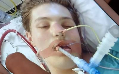 Ewan (18) op randje van dood door e-sigaret: 'Dat ding heeft mijn leven verpest’