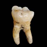 Wetenschappers halen uit 2.500 jaar oude tanden verrassende inzichten over kindertijd en voeding in Etruskische gemeenschap