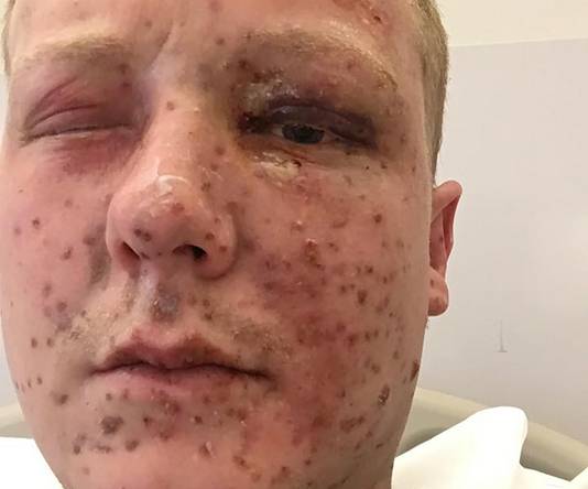 Erwin Kan Ontploffing Navertellen Rotterdam Ad Nl