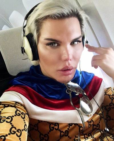 Faceliftveslaafde Rodrigo: ‘Mijn neus zakt na tien operaties opeens weg in mijn gezicht’