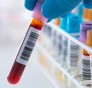 Niet alleen huisartsen, ook radiologen en klinisch biologen krijgen meer geld