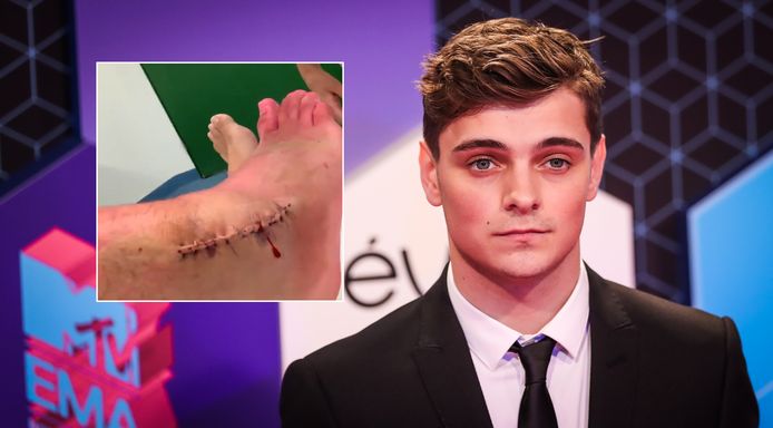 Martin Garrix pareert criticaster over blessure met heftig ...