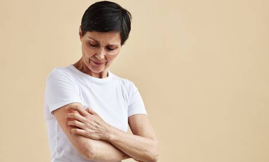 Allergisch voor muggen? Alles over het Skeeter-syndroom: van symptomen tot behandeling