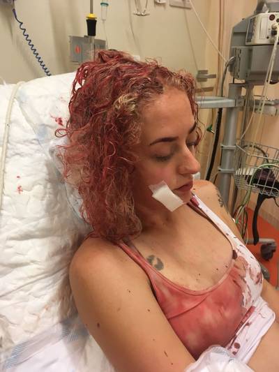 Vechthond neemt zwangere Marissa (20) uit Kampen te grazen