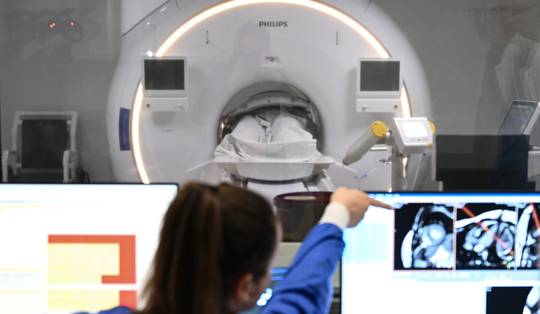 Creatief factureren: radiologen maken goed wat ze elders verliezen
