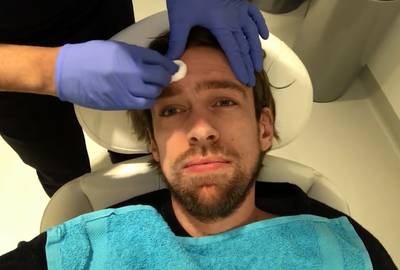 Mattie Valk (32) laat frons uit voorhoofd spuiten