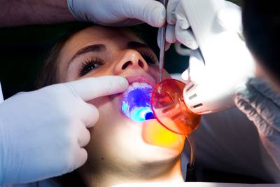 Tienergebitten zien er steeds slechter uit