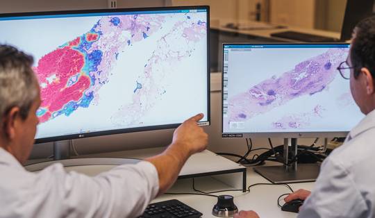 Analyse van tumorstaal verloopt bijna 20 procent sneller dankzij AI in Antwerps ziekenhuis