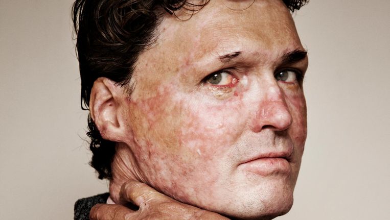 Wat Te Doen Tijdens Hittegolf Oortjes Van De Kat Insmeren En De