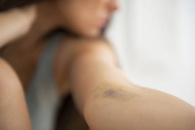 Verdachte huiselijk geweld sloeg in op bezoek ex-vriendin