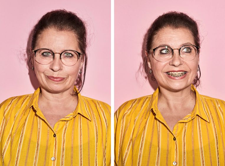 Steeds Meer Mensen Dragen Een Beugel Zijn Ze Echt Altijd Nodig De Volkskrant