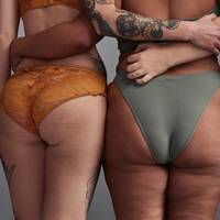 Dit kun je doen tegen cellulite