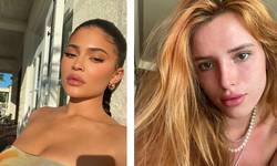 Het tijdperk van extreme lipfillers lijkt voorbij, al blijft de ingreep populair. Dermatoloog: “Sommigen zijn piepjong”