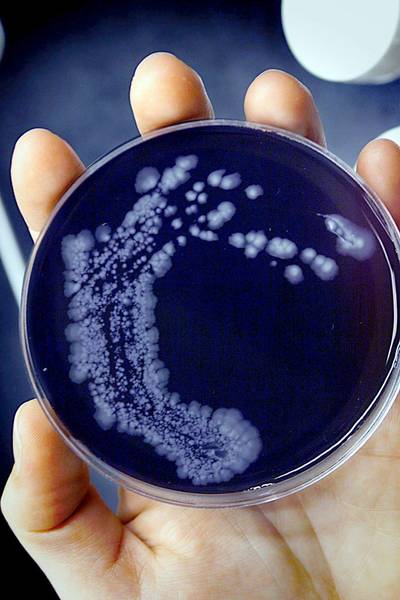 Meer legionellaslachtoffers, drie Brabantse doden