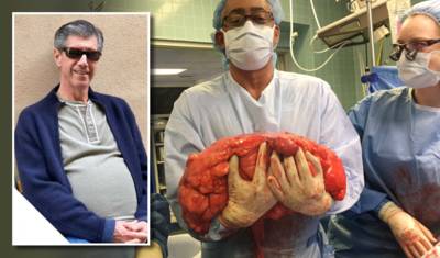 'Ik lust helemaal geen bier': Bierbuik blijkt kwaadaardige tumor van 13 kilo