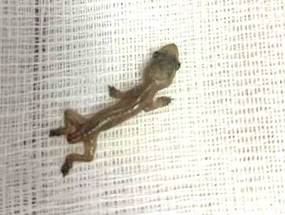 Arts verwijdert piepklein babyhagedisje uit oor Thaise vrouw